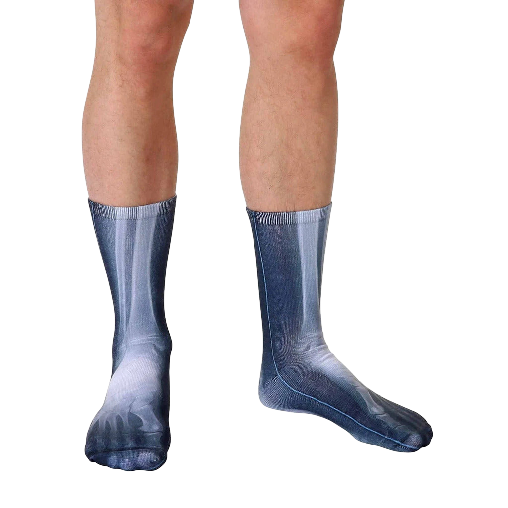 X-Ray