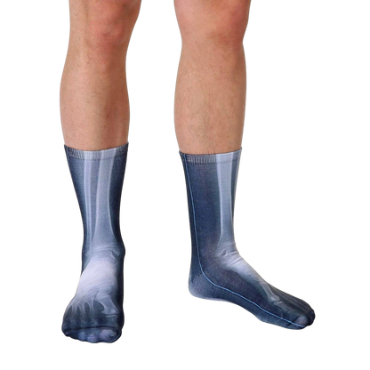 X-Ray