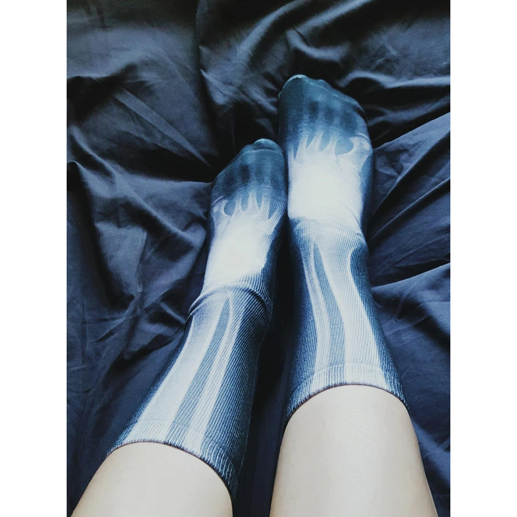 X-Ray