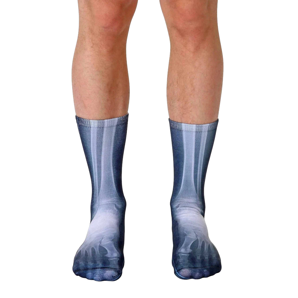 X-Ray