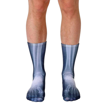 X-Ray