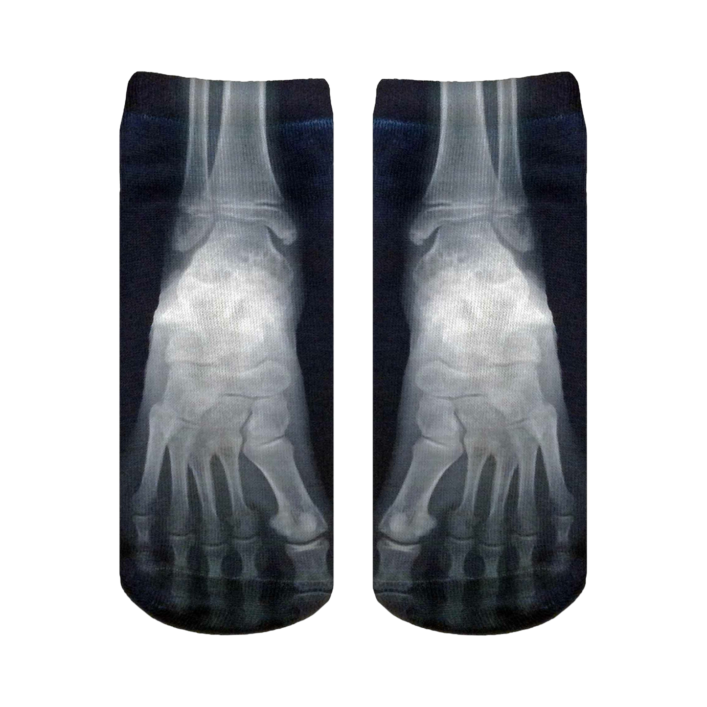 X-Ray