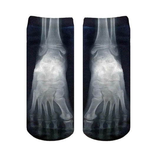 X-Ray