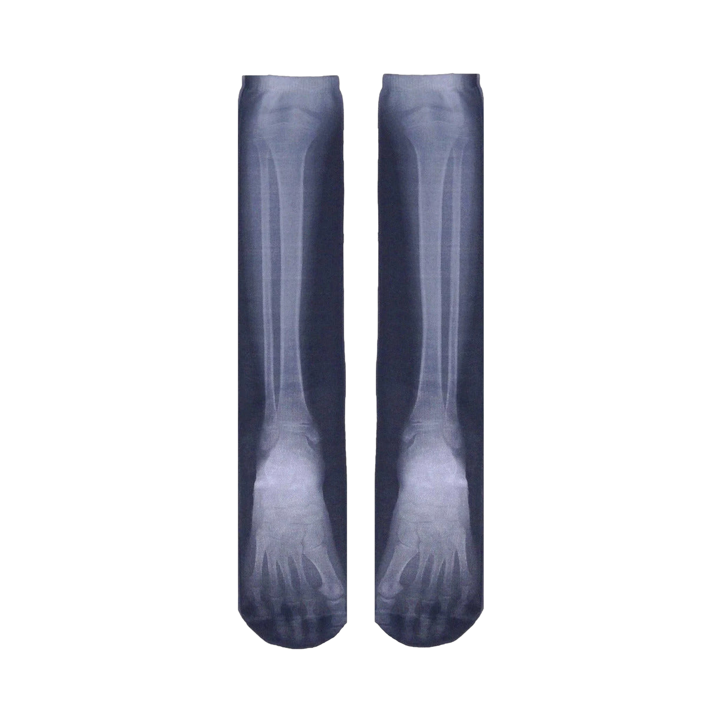 X-Ray