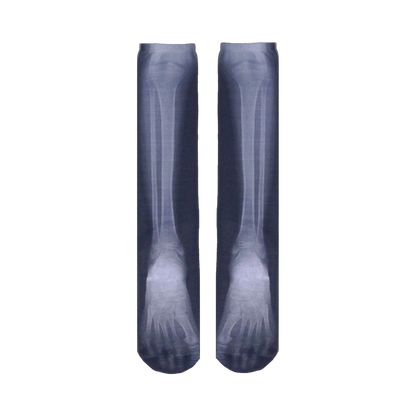 X-Ray