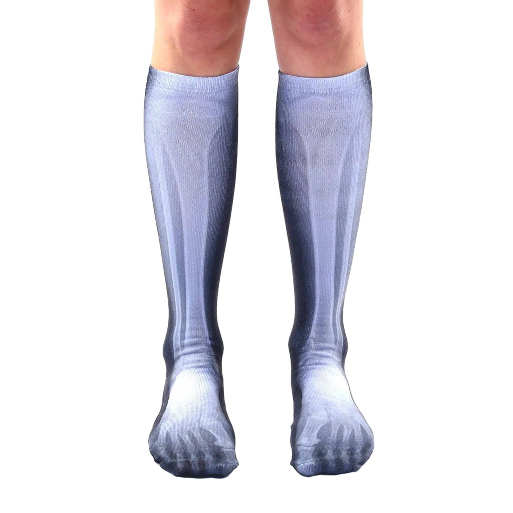 X-Ray