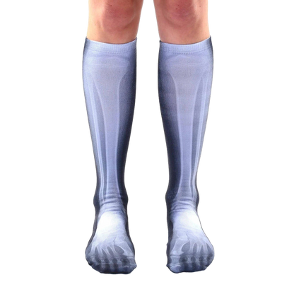 X-Ray