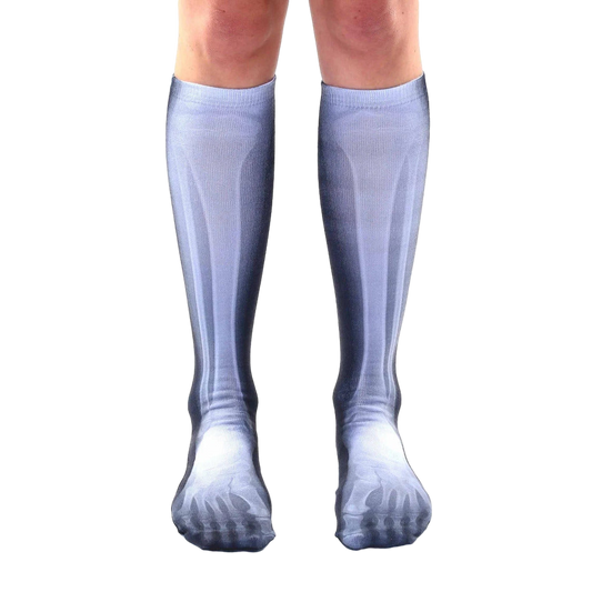 X-Ray