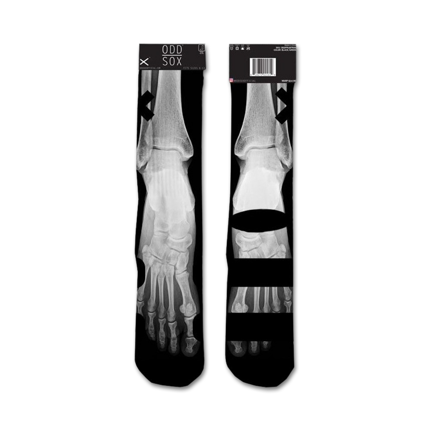 Bones