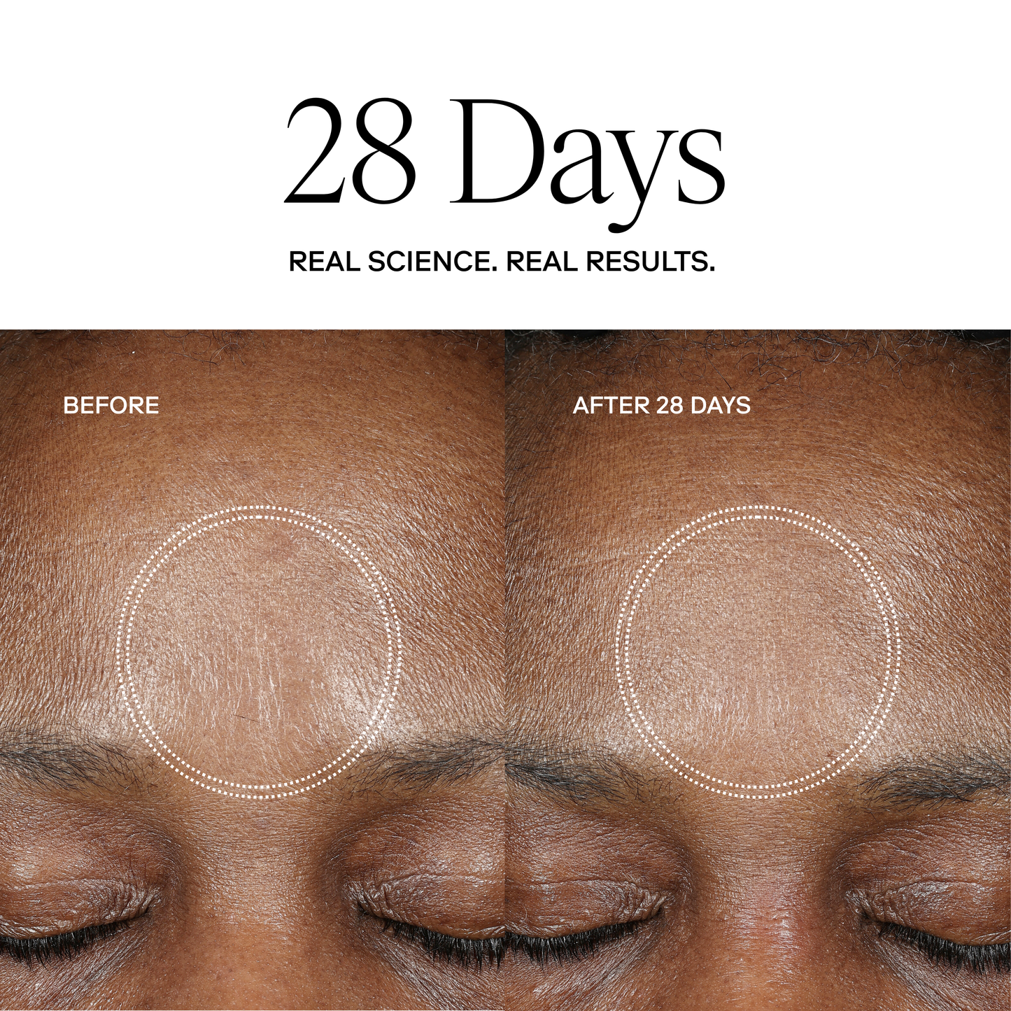 EXO H-SERUM™ Hyaluronic Acid Treatment / eXo³ Exosomes®