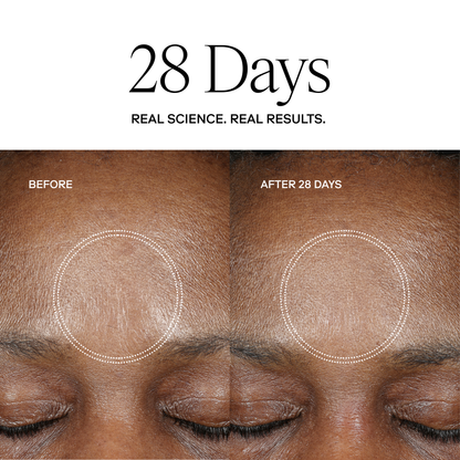 EXO H-SERUM™ Hyaluronic Acid Treatment / eXo³ Exosomes®